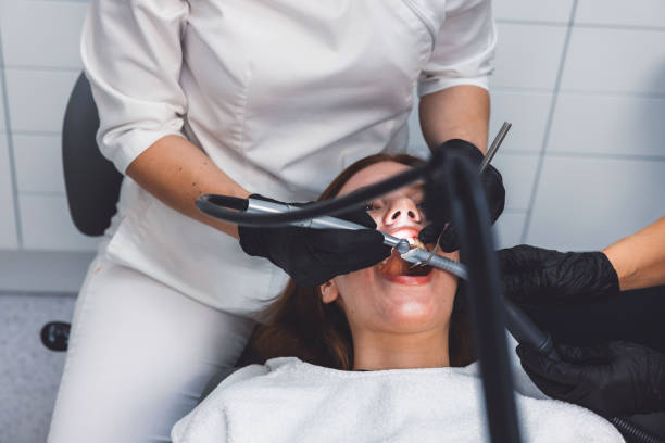 Best Knocked-Out Tooth (Avulsed Tooth) Treatment in Culver City, CA